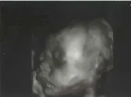 4Dエコーについて