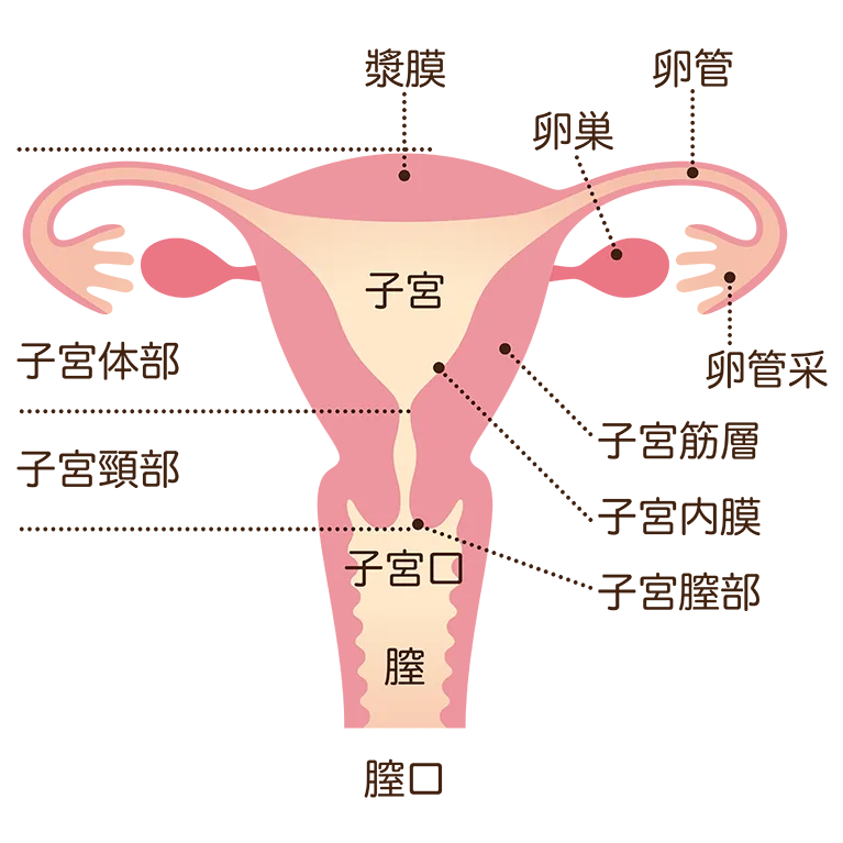 子宮内膜症とは
